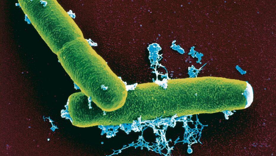 Anthrax Bakterien wie sie unter dem Mikroskop gesehen werden können.